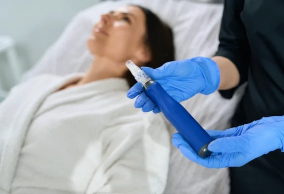 A patient receiving a microneedling treatment in Bucks County, PA